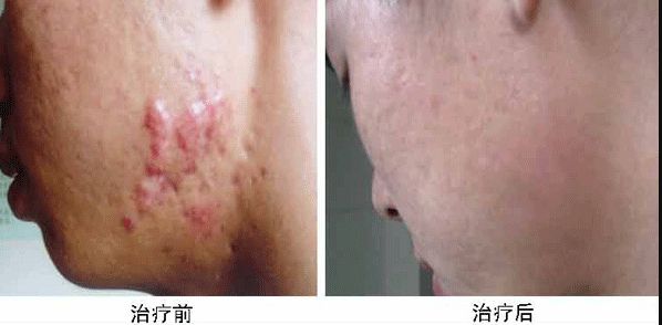 合肥哪家整容醫(yī)院雙眼皮做得好？專業(yè)整形外科專家推薦