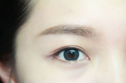 寧波哪家醫(yī)院割雙眼皮效果好？