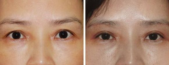 上海激光美容醫(yī)院排名及熱門選擇，哪家好？
