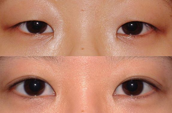 蘇州打瘦臉針哪家醫(yī)院好？2023年蘇州瘦臉針治療排行榜發(fā)布