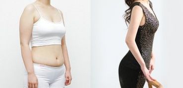 成都做雙眼皮，哪家醫(yī)院專業(yè)可靠？