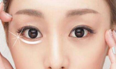 荊州割眼袋哪家醫(yī)院好？眼袋修復(fù)專家為您推薦！