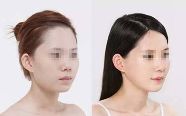 北京隆胸醫(yī)生排行：網(wǎng)友推薦的實力派、口碑出眾的美容專家值得關注