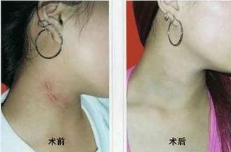 南寧哪家醫(yī)院治痘效果好？選擇明星們的美肌秘密推薦的南寧優(yōu)質(zhì)醫(yī)院