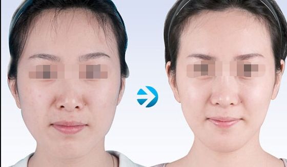 蘇州哪家吸脂好又實(shí)惠？專業(yè)美容機(jī)構(gòu)為您推薦