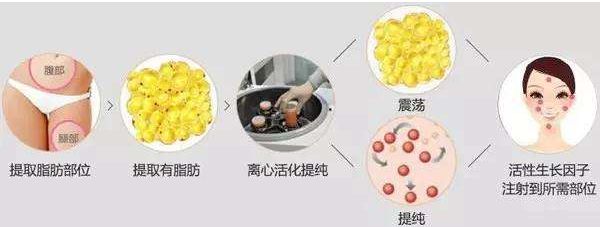 哈爾濱哪家醫(yī)院的去皺針效果好？