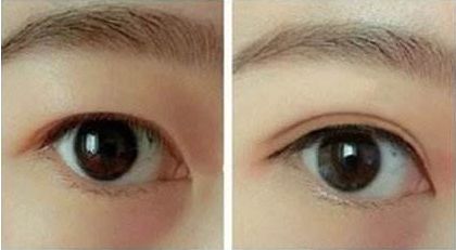 合肥哪家整形醫(yī)院好口碑好服務好值得推薦？