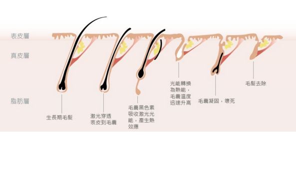 深圳哪家激光祛斑醫(yī)院口碑好？