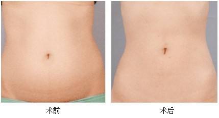 2023湘潭彩光美白嫩膚專家前10位排行榜(劉佑文、熊宜文、熊志能幫你圓夢)
