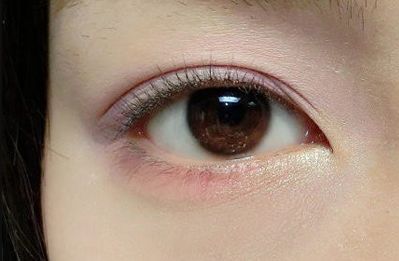 王世虎拉皮和脂肪填充的效果如何？有哪些多樣化的項(xiàng)目值得選擇？技術(shù)是否可靠可證？