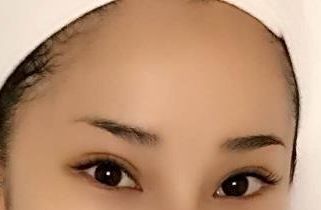 上海醫(yī)院最好治療皮膚疤痕的?？剖悄募?？