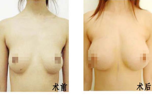 北京景區(qū)楊斌突嘴手術(shù)矯正效果如何？從個(gè)人實(shí)力和大眾評(píng)價(jià)來分析