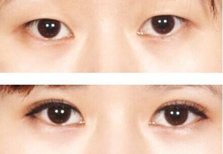 榆林市美容哪家醫(yī)院好？榆林市頂級美容醫(yī)院推薦
