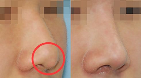 福州哪家醫(yī)院做疤痕好？比較全面的福州疤痕治療醫(yī)院推薦給您！