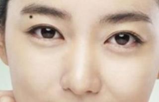 認識眼部大咖，探索秦宏偉醫(yī)生的簡介及雙眼皮案例分享