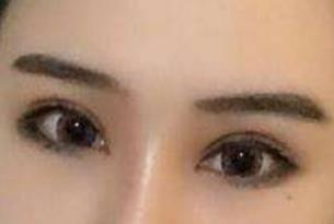 貴陽(yáng)梁安裕醫(yī)生技術(shù)在線解析腹壁成型效果，怎么樣？