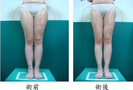 昆明哪家治痘痘好的醫(yī)院，痘痘問題如何有效解決？