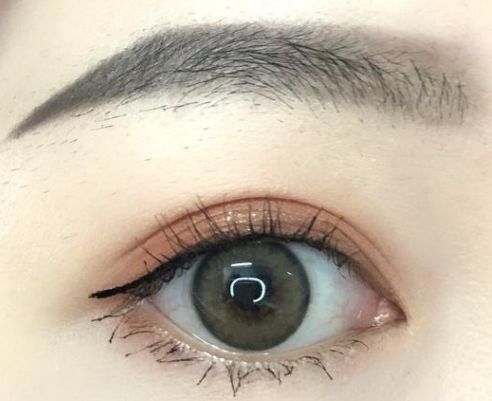 成都哪家美容醫(yī)院的埋線減肥效果好？