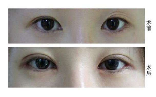 天津修復唇腭裂的醫(yī)院哪家好？專業(yè)解讀！