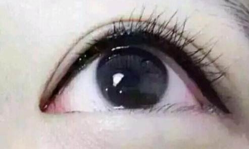 廣州曙光醫(yī)學美容醫(yī)院的黎凍抗衰老療法有多出色？
