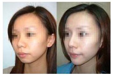 秦皇島美容美體哪家好？刷爆朋友圈的秘密美容院大揭秘！