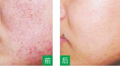 永州美辰醫(yī)療整形醫(yī)院的價格如何？收費標(biāo)準(zhǔn)透明公開，術(shù)前注意事項必看！