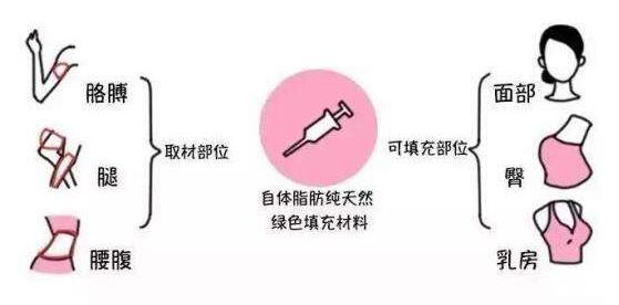 成都潘紅偉吸脂手術效果如何？專家解讀！