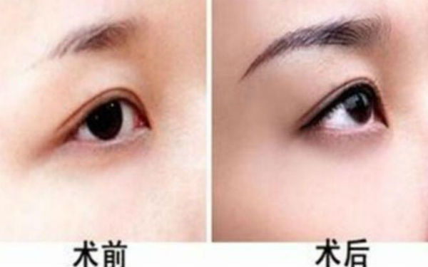 西京醫(yī)院超贊整形醫(yī)生與驚人隆鼻案例，受歡迎至極！