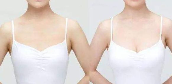 威海假體豐胸醫(yī)院哪家好？從專家口碑、手術效果看威海頂級醫(yī)院推薦！