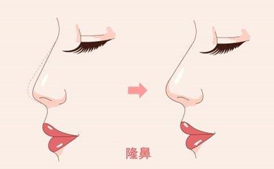 2023西安口周紋注射填充評分10強醫(yī)生(李朋娟、張筠莉、唐龍多院同臺競技爭高下)