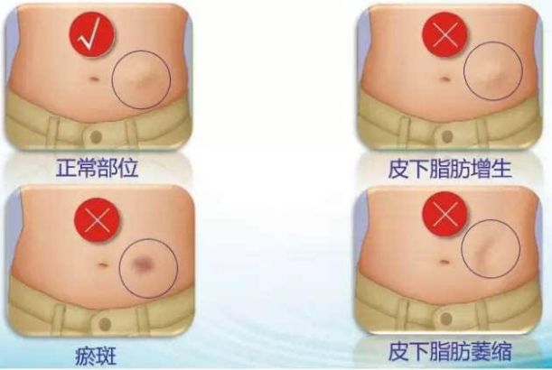哈爾濱整形醫(yī)院哪家好？選擇哈爾濱整容醫(yī)院前必知的五大關(guān)鍵點