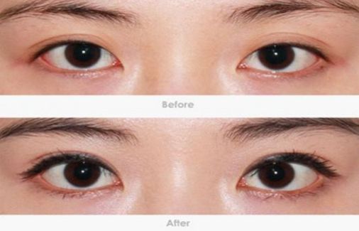 柳州哪家醫(yī)院做疤痕切除好？-獨(dú)家分享柳州疤痕切除醫(yī)院排行榜