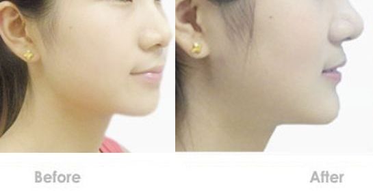 蘇州嘴唇改薄哪家醫(yī)院好？專(zhuān)業(yè)的整形醫(yī)院推薦