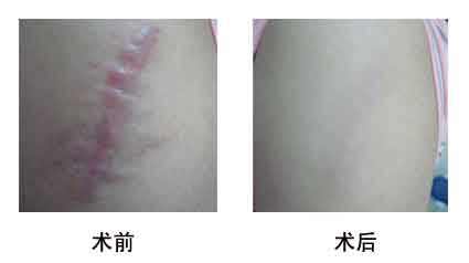 2023淮北光子點(diǎn)痣專家評(píng)價(jià)前十強(qiáng)(劉家賀、方芹、任學(xué)東內(nèi)行直呼)