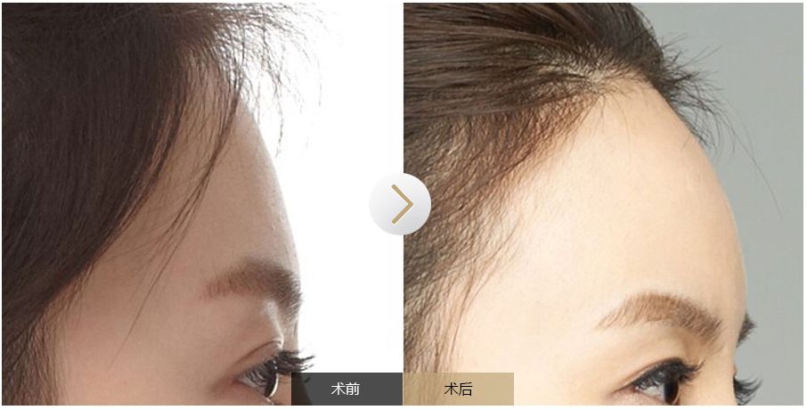 南寧點(diǎn)痣需求旺盛，哪家醫(yī)院是最受歡迎的？