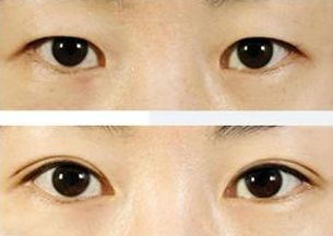 上海治療青春痘的專家推薦，哪家醫(yī)院效果最佳？