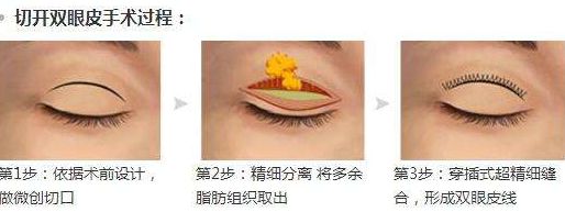 淮安光子嫩膚醫(yī)院哪家好？專家為您推薦5家權(quán)威醫(yī)院