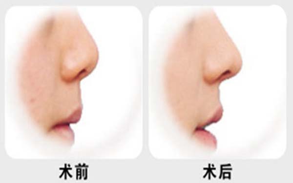 上海專業(yè)唇部整形五大口碑專家公布，人氣名醫(yī)張余光、周佳、戴傳昌等榜上有名