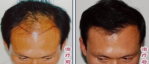 榆林醫(yī)專附屬醫(yī)院醫(yī)學(xué)整形美容中心怎么樣？榆林醫(yī)專附屬醫(yī)院醫(yī)學(xué)整形美容中心簡(jiǎn)介|醫(yī)生團(tuán)隊(duì)|口碑評(píng)價(jià)！