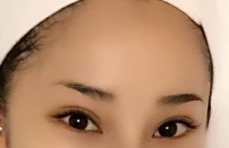 合肥哪家醫(yī)院臉部激光治療效果好，值得推薦？