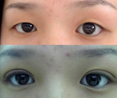 濟(jì)南哪家整形醫(yī)院的拉皮效果好且價(jià)格合適？