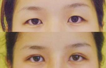 大慶微整形醫(yī)院哪家好？頂級(jí)專(zhuān)家為您解讀微整形醫(yī)院選擇指南！