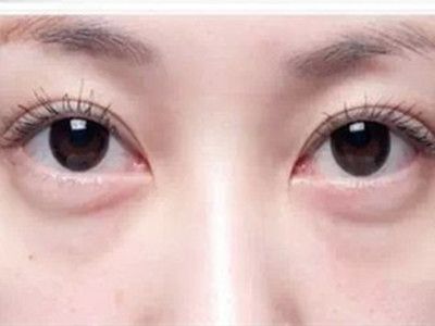 寧波祛斑哪家醫(yī)院好？精選寧波祛斑專業(yè)醫(yī)院推薦！