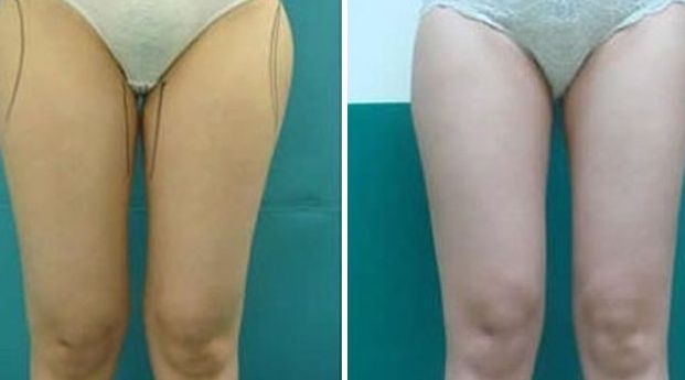 揭陽激光美容醫(yī)院哪家好？選擇揭陽最佳激光美容醫(yī)院的7個關鍵要素！