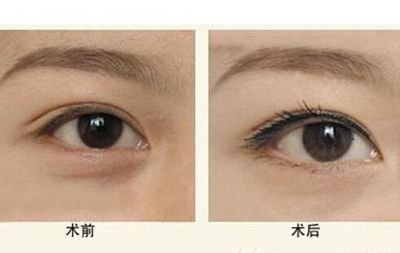 寧波隆鼻Top5醫(yī)生：技術(shù)精湛，聲譽(yù)卓越，口碑贊不絕口！