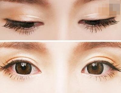 西寧豐胸整形醫(yī)院排名前三，專業(yè)醫(yī)生推薦！