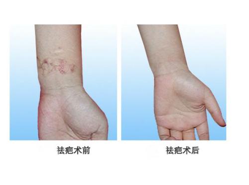 2023上海晶塑去痘印權(quán)威醫(yī)生榜單TOP10強(qiáng)(李科、陳杰、陳建君這些專家推薦給您)