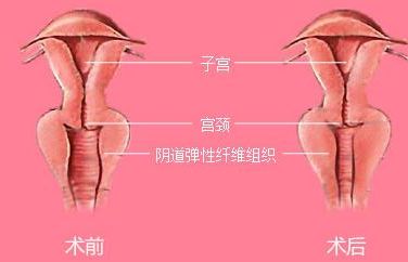 長沙靠譜矯正醫(yī)院哪家好？解答你所有的疑慮！