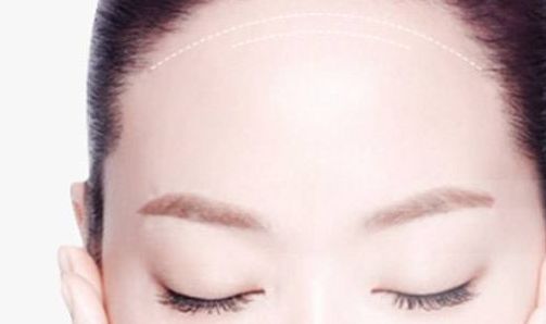 南京做修復(fù)雙眼皮哪家好？解析南京修復(fù)雙眼皮的最佳選擇