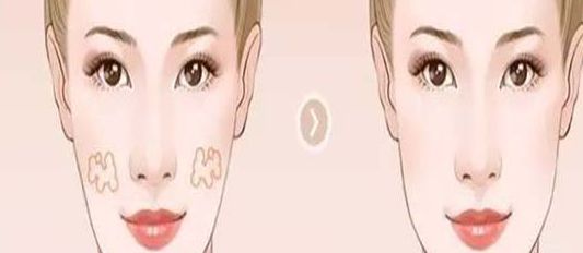 南京哪家醫(yī)院的小陰唇整形效果好？